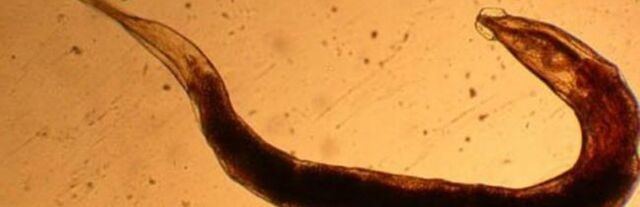 παράσιτο σκουλήκι από το ανθρώπινο σώμα